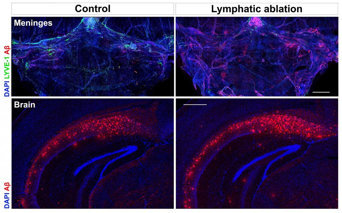 Brain Discovery Could Block Aging's Terrible Toll on the Mind ...