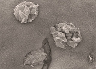 Disease-causing bacterial invaders aided by failure of immune system ...