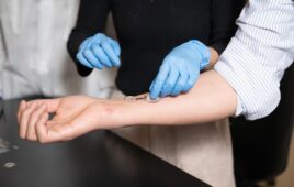 The iCares smart bandage on Wei Gao's arm. The bandage is composed of a flexible, biocompatible polymer strip that can be 3D printed at low cost. Credit Lance Hayashida/Caltech