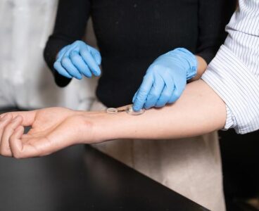 The iCares smart bandage on Wei Gao's arm. The bandage is composed of a flexible, biocompatible polymer strip that can be 3D printed at low cost. Credit Lance Hayashida/Caltech