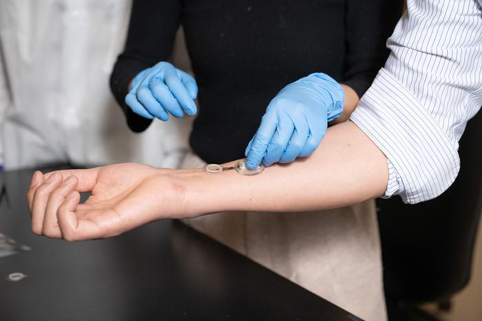 The iCares smart bandage on Wei Gao's arm. The bandage is composed of a flexible, biocompatible polymer strip that can be 3D printed at low cost. Credit Lance Hayashida/Caltech