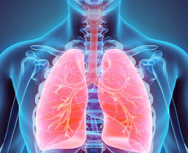 Patient survives for 48 hours with artificial lungs