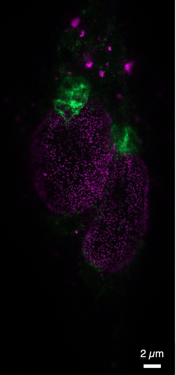 Precision Cells Why the techbio Precigenetics aims to swap cell 'autopsies' with live ...