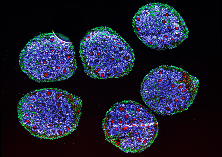 Human brain organoids grown from stem cells, showing neurons and dendrites (green), forebrain cells (blue), and tight junctions between cells (red). In a 2022 study, researchers at the Broad Institute tracked organoid development over six months and found the same cell types arose in the same order and expressed the same genes as cells in the developing human embryo. Credit: Noelia Anton Bolanos and Irene Faravelli/Broad Institute