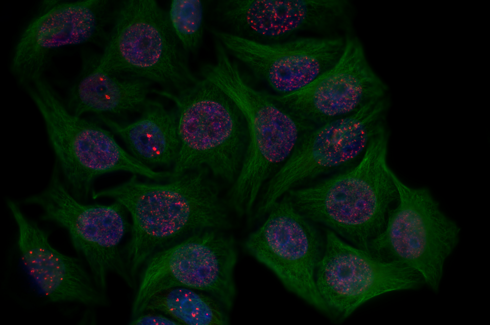 Drug-induced DNA damage in human cancer cells. Red foci (53BP1 protein) mark sites of genome breaks, green shows the cytoskeleton (tubulin), and blue marks DNA (DAPI). DNA damage is one trigger that can push cells into senescence, the state Rubedo's RLS-1496 is designed to target. Credit: Velichko Artem / Wikimedia Commons (CC BY 4.0)