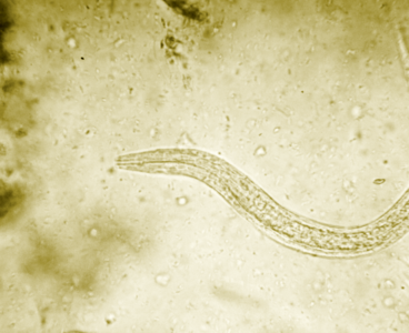 Genetically modified hookworms could produce and deliver therapeutics within a host