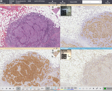 Leica, Indica Labs and Lunit team up as AI biomarker scoring moves toward clinical scale