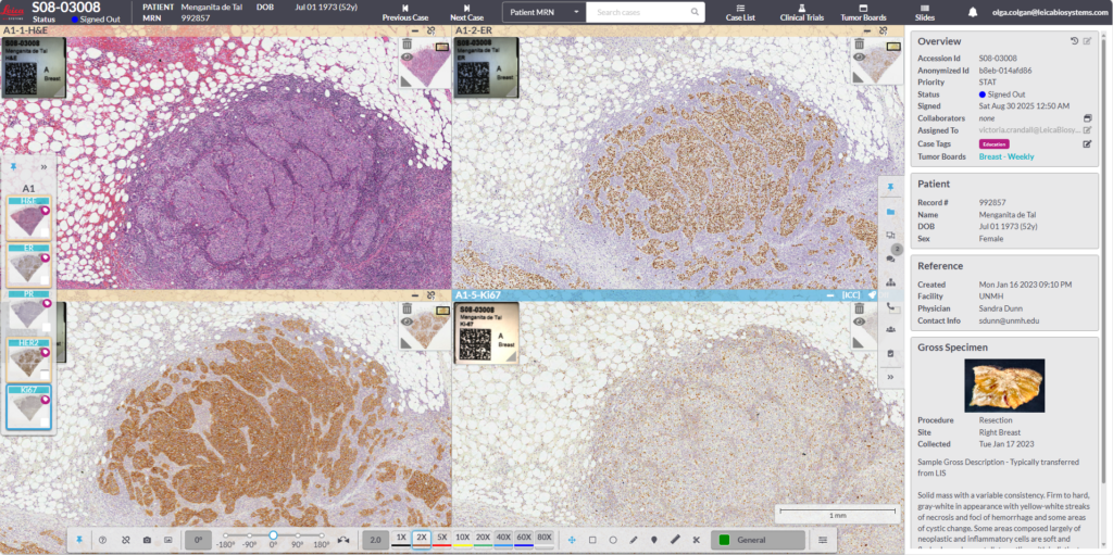 Digital pathology enables high-resolution imaging of slides, allowing users to zoom in and align images side-by-side for more effective comparison across tissue sections and IHC markers.
