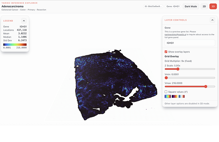 An image from the TARIO-2 Inference Explorer (Adenocarcinoma) | Noetik