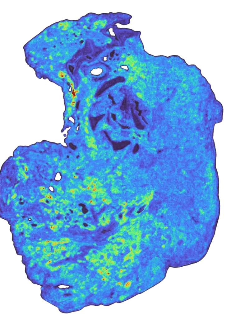 A TARIO-2 prediction of spatial gene expression across a tumor section, inferred from a routine H&E slide alone. Warmer areas (yellow to red) mark higher predicted expression, cooler areas (blue to purple) lower. | Noetik