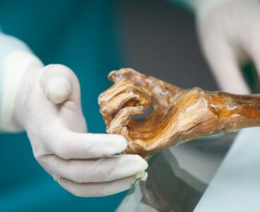 Beyond the sequence: how Ötzi the Iceman exposed the blind spots of pure metagenomics