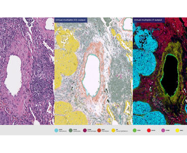 Mayo Clinic backs ViewsML in $4.9M round to advance virtual biomarker staining